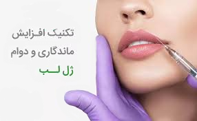 راهکارهای افزایش ماندگاری تزریق ژل لب