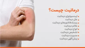 علت های بروز درماتیت تماسی و انواع آن
