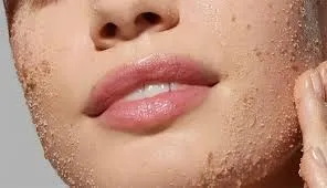 لایه‌برداری شیمیایی