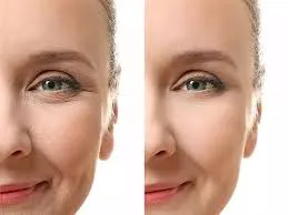 روش‌ های غیرجراحی جوانسازی پوست