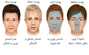 تشخیص پوست حساس