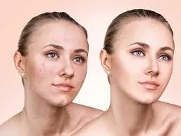 روش‌های آبرسانی به پوست