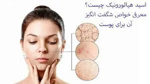 خصوصیات اسید هیالورونیک