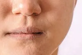 بررسی علل و درمان‌ های مختلف خشکی پوست