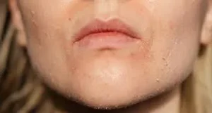 بررسی علل و درمان‌ های مختلف خشکی پوست