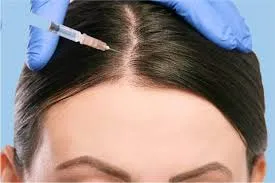 بررسی اثربخشی روش‌های مختلف مزوتراپی